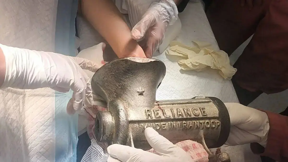 جراحت شدید دست زن کارگر در چرخ‌گوشت در مرکز تهران